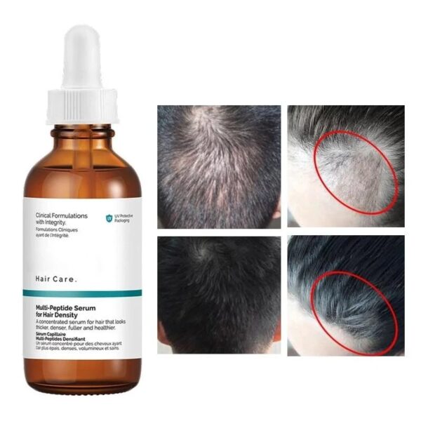 The Ordinary For Hair Density Multi-Peptide Serum 60ml