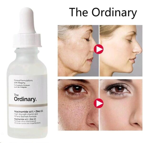 The Ordinary Niacinamide 10%+Zinc1% - 30ml - Image 3